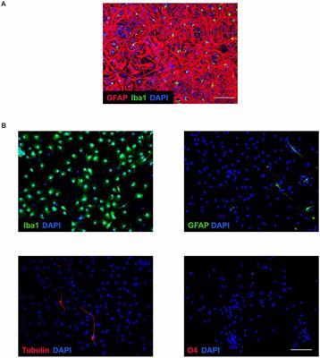 Microglia Stimulation by Protein Extract of Injured Rat Spinal Cord. A Novel In vitro Model for Studying Activated Microglia